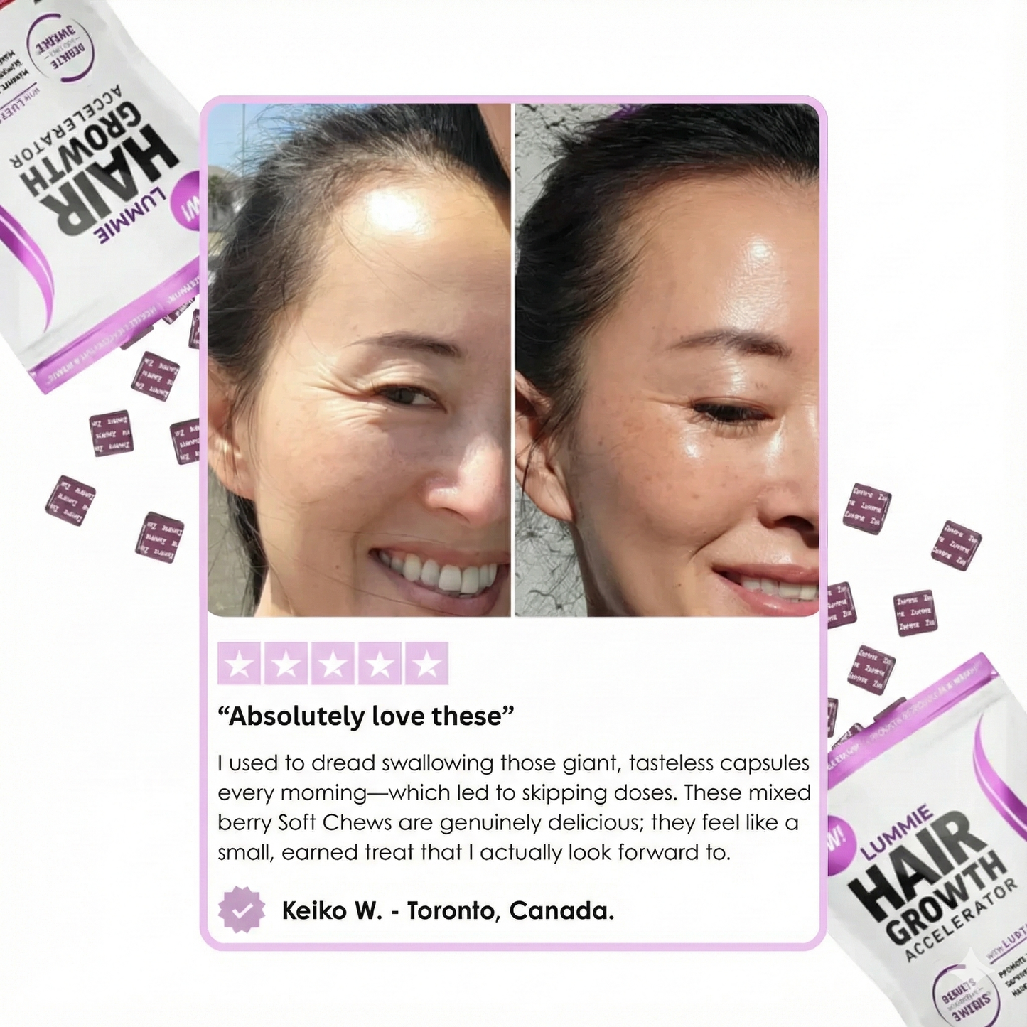 LUMMIE hair growth gummies